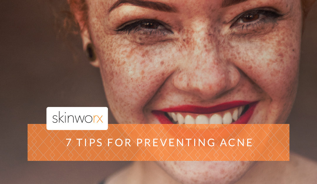7 Tips For Preventing Acne