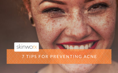 7 Tips For Preventing Acne